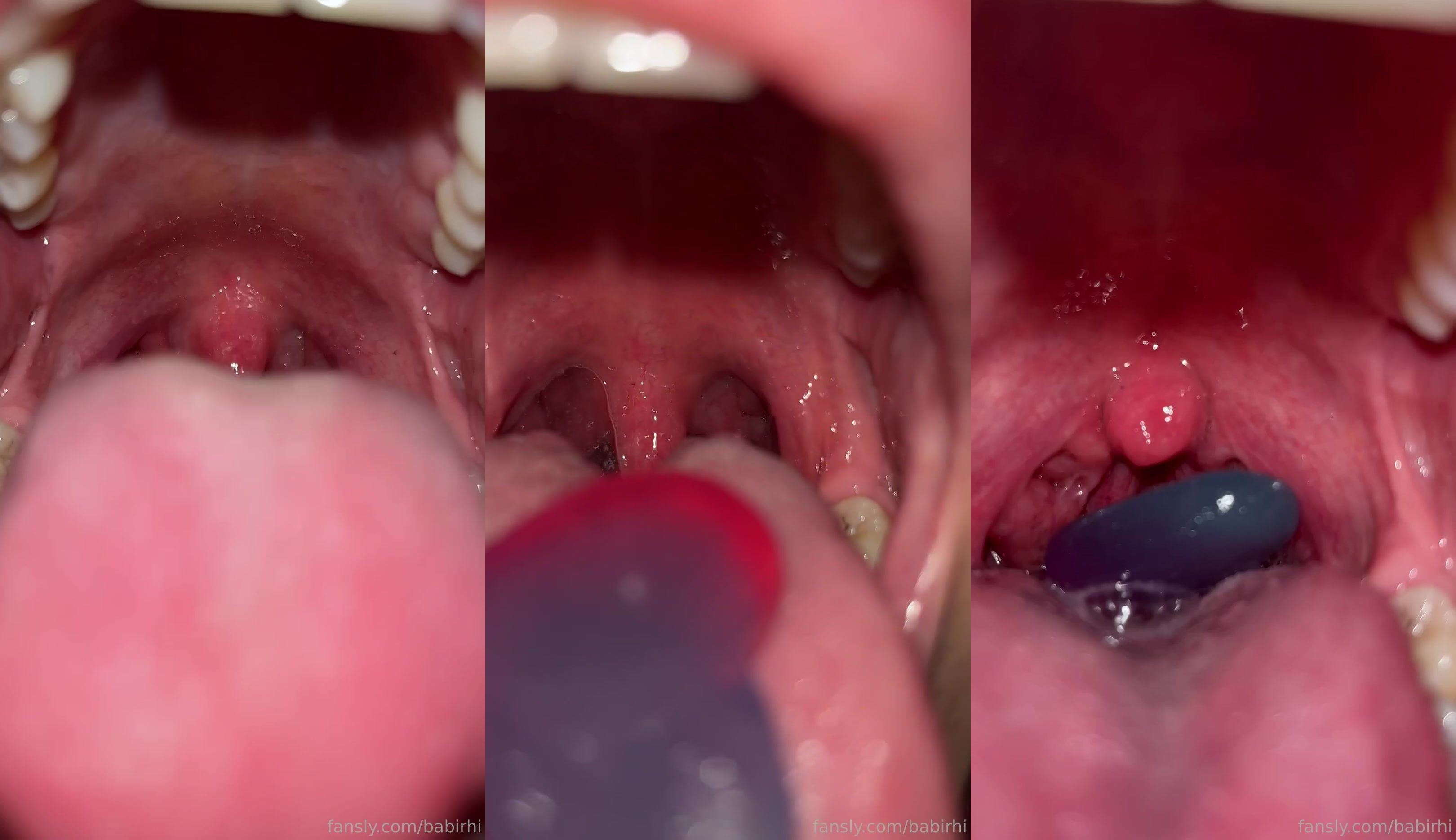 Babi Rhi Shows Her Uvula